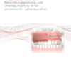 Versorgungskonzepte für zahnlose Patienten 13.1 - Deutsch