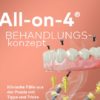 All-on-4 Behandlungskonzept (E-Book)